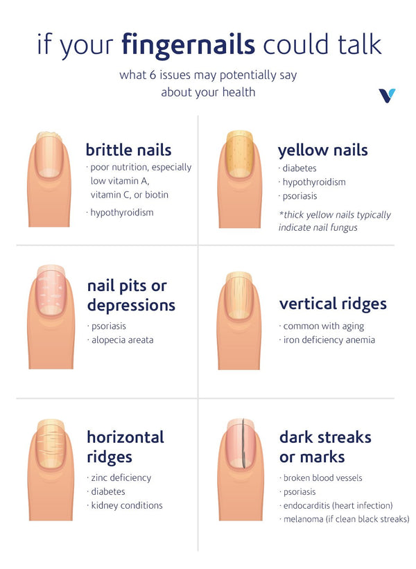 What Your  NAILS CAN TELL YOU ABOUT YOUR HEALTH